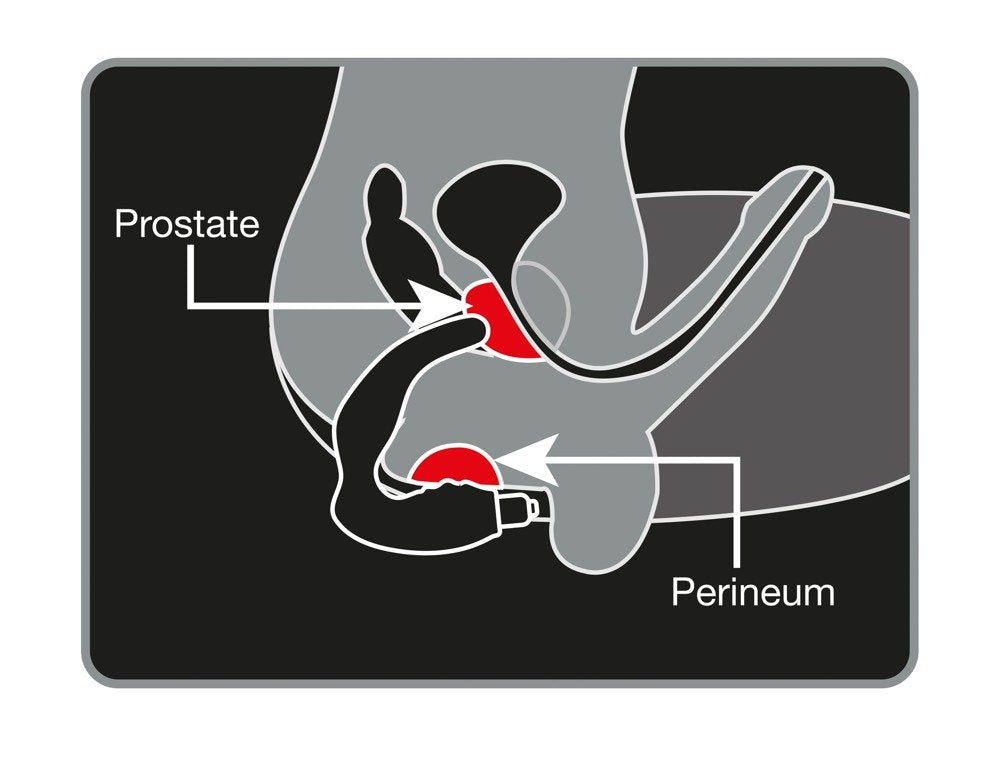 Stimolatore Prostatico